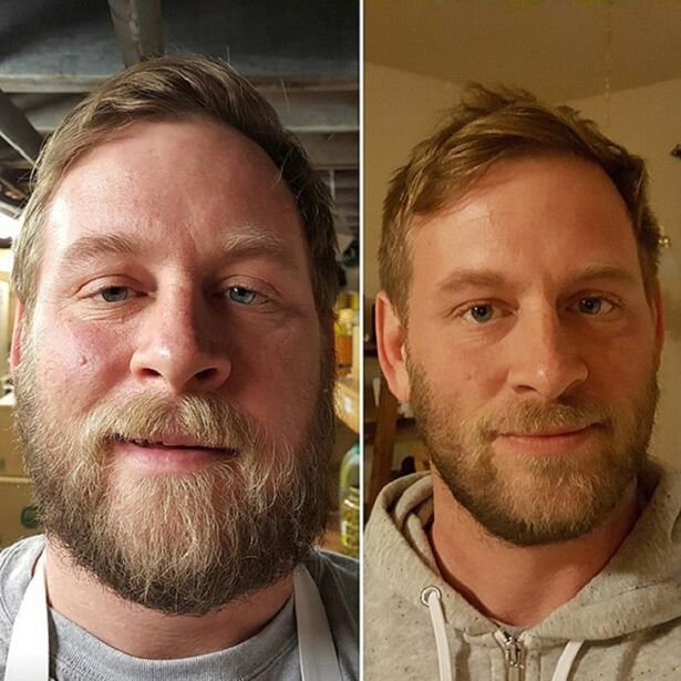 l'apparence de la personne avant et après l'arrêt de l'alcool